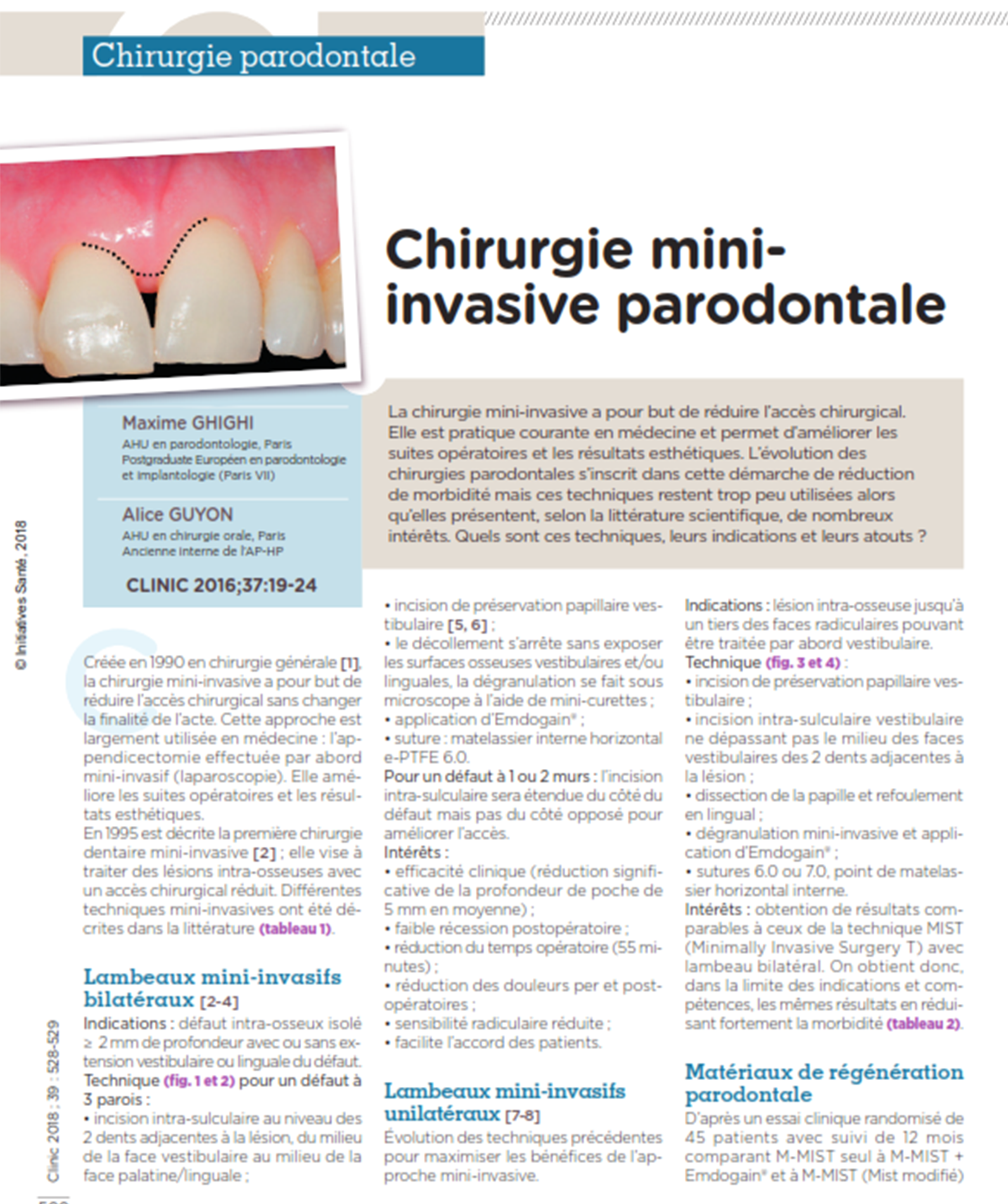 article sur le thème de la chirurgie parodontale mini-invasive